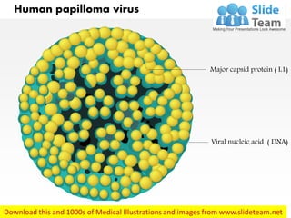 Human papilloma virus
Major capsid protein ( L1)
Viral nucleic acid ( DNA)
 