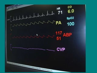 Human patient simulation | PPT