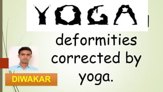 Human postural
deformities
corrected by
yoga.DIWAKAR
 