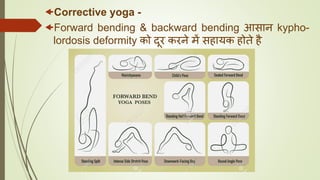 Corrective yoga -
Forward bending & backward bending आसान kypho-
lordosis deformity को दूर करने में सहायक होते है
 