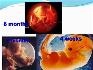4 weeks4 weeks5 months5 months
8 months8 months
 