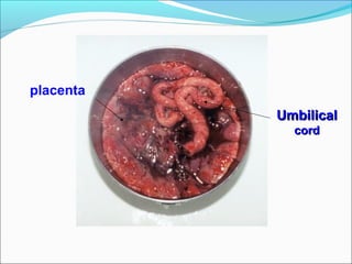 placenta
UmbilicalUmbilical
cordcord
 