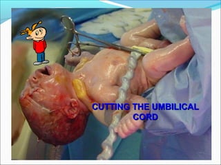 CUTTING THE UMBILICALCUTTING THE UMBILICAL
CORDCORD
 