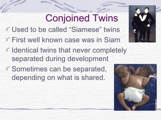Conjoined Twins
Used to be called “Siamese” twins
First well known case was in Siam
Identical twins that never completely
separated during development
Sometimes can be separated,
depending on what is shared.
 