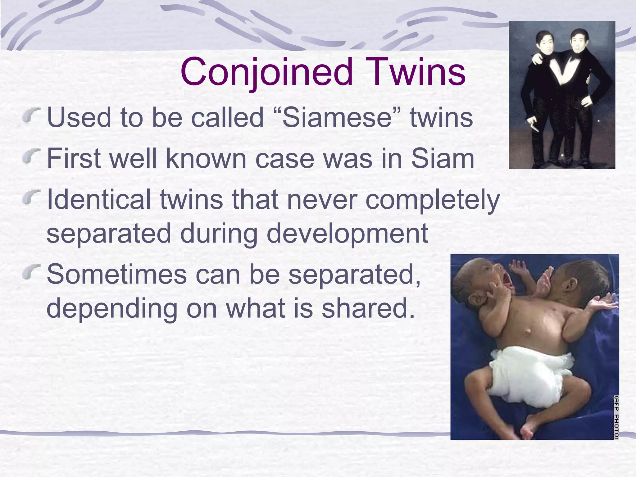 Conjoined Twins
Used to be called “Siamese” twins
First well known case was in Siam
Identical twins that never completely
separated during development
Sometimes can be separated,
depending on what is shared.
 