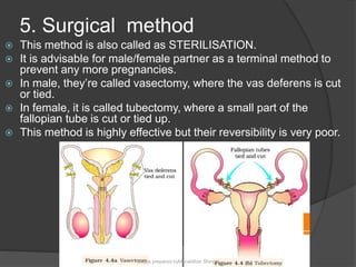 Tubesctomy Methods Human reproduction | PPTX