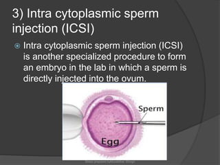Icsi Lab Human reproduction | PPTX