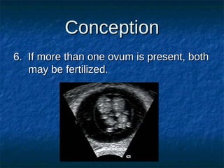 Conception
6. If more than one ovum is present, both
may be fertilized.

 