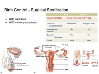 Birth Control - Surgical Sterilization
● NOT castration
● NOT ovariohysterectomy
 