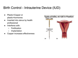 Birth Control - Intrauterine Device (IUD)
● Plastic+Copper or
plastic+hormones
● Inserted into uterus by health
professional
● Interferes with:
○ Fertilization
○ Implantation
● Copper increases effectiveness
 
