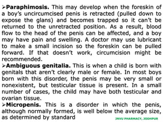 JNVU PHARMACY, JODHPUR
Paraphimosis. This may develop when the foreskin of
a boy’s uncircumcised penis is retracted (pulled down to
expose the glans) and becomes trapped so it can’t be
returned to the unretracted position. As a result, blood
flow to the head of the penis can be affected, and a boy
may have pain and swelling. A doctor may use lubricant
to make a small incision so the foreskin can be pulled
forward. If that doesn’t work, circumcision might be
recommended.
Ambiguous genitalia. This is when a child is born with
genitals that aren’t clearly male or female. In most boys
born with this disorder, the penis may be very small or
nonexistent, but testicular tissue is present. In a small
number of cases, the child may have both testicular and
ovarian tissue.
Micropenis. This is a disorder in which the penis,
although normally formed, is well below the average size,
as determined by standard
 