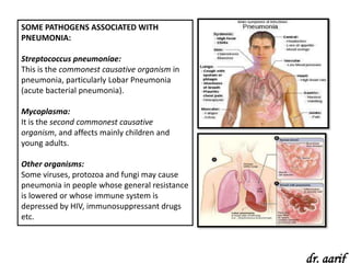 SOME PATHOGENS ASSOCIATED WITH
PNEUMONIA:

Streptococcus pneumoniae:
This is the commonest causative organism in
pneumonia, particularly Lobar Pneumonia
(acute bacterial pneumonia).

Mycoplasma:
It is the second commonest causative
organism, and affects mainly children and
young adults.

Other organisms:
Some viruses, protozoa and fungi may cause
pneumonia in people whose general resistance
is lowered or whose immune system is
depressed by HIV, immunosuppressant drugs
etc.



                                               dr. aarif
 