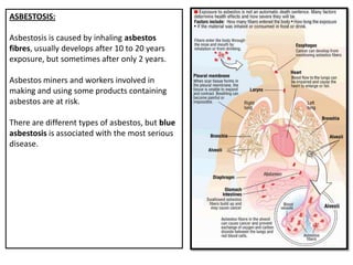 ASBESTOSIS:

Asbestosis is caused by inhaling asbestos
fibres, usually develops after 10 to 20 years
exposure, but sometimes after only 2 years.

Asbestos miners and workers involved in
making and using some products containing
asbestos are at risk.

There are different types of asbestos, but blue
asbestosis is associated with the most serious
disease.
 
