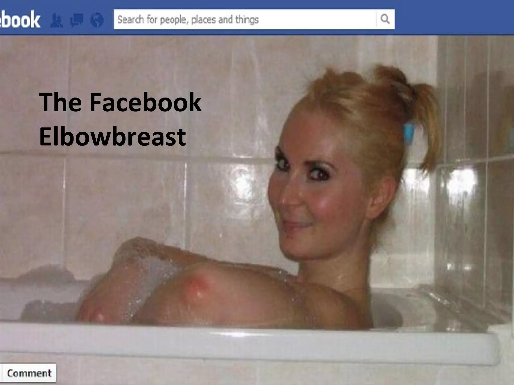 The Facebook
Elbowbreast
 