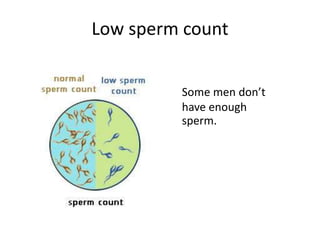 Low sperm count
Some men don’t
have enough
sperm.
 