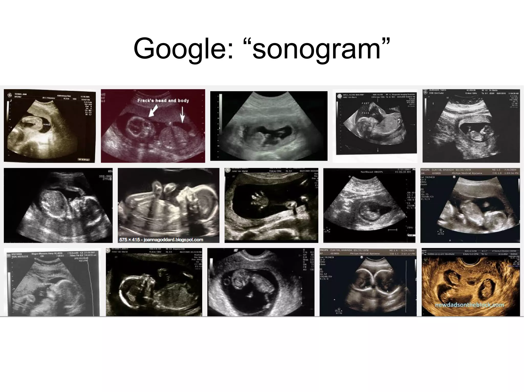 Google: “sonogram”

 