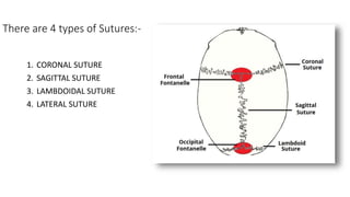 There are 4 types of Sutures:-
1. CORONAL SUTURE
2. SAGITTAL SUTURE
3. LAMBDOIDAL SUTURE
4. LATERAL SUTURE
 