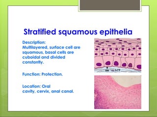 Stratified squamous epithelia
Description:
Multilayered, surface cell are
squamous, basal cells are
cuboidal and divided
constantly.
Function: Protection.
Location: Oral
cavity, cervix, anal canal.
 