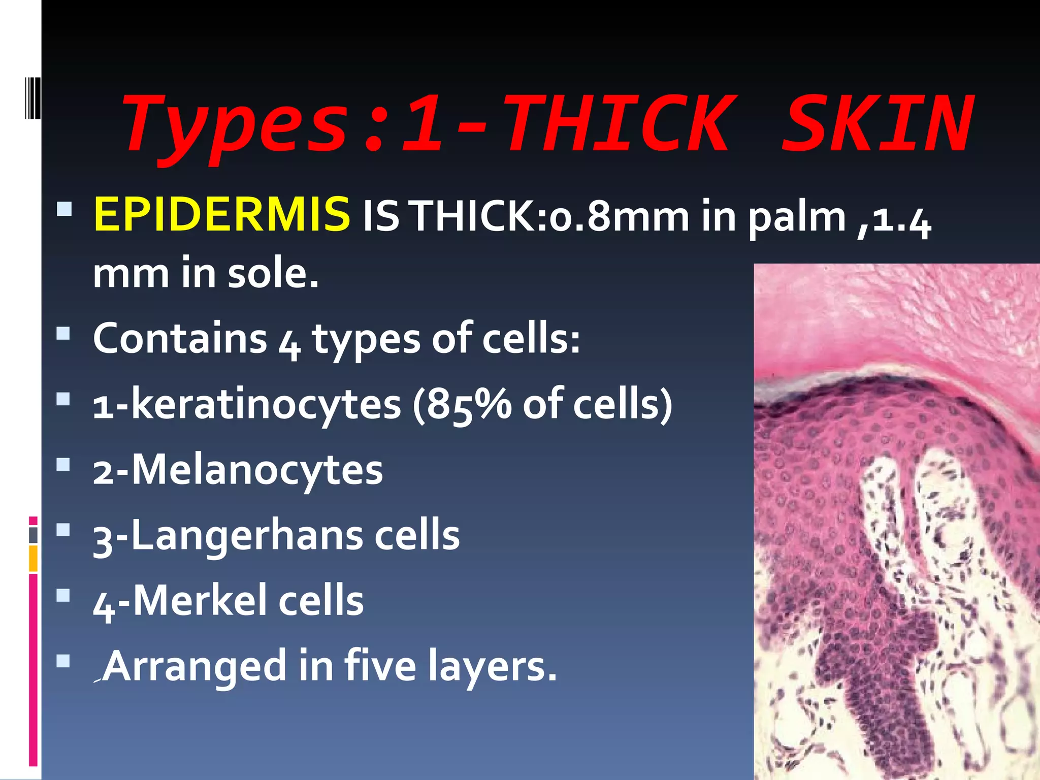 Types:1-THICK SKIN
 EPIDERMIS IS THICK:0.8mm in palm ,1.4
    mm in sole.
   Contains 4 types of cells:
   1-keratinocytes (85% of cells)
   2-Melanocytes
   3-Langerhans cells
   4-Merkel cells
   ِArranged in five layers.
 