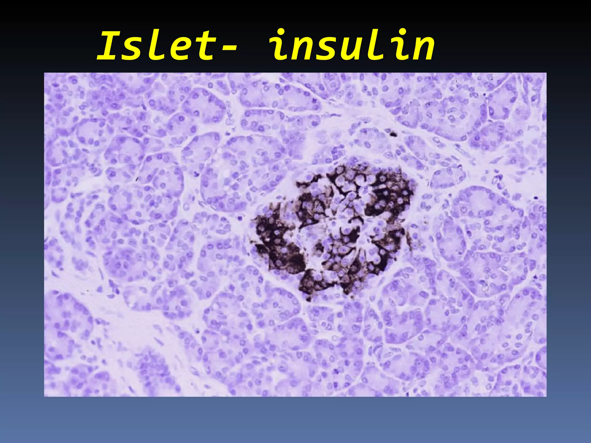 Islet- insulin
 