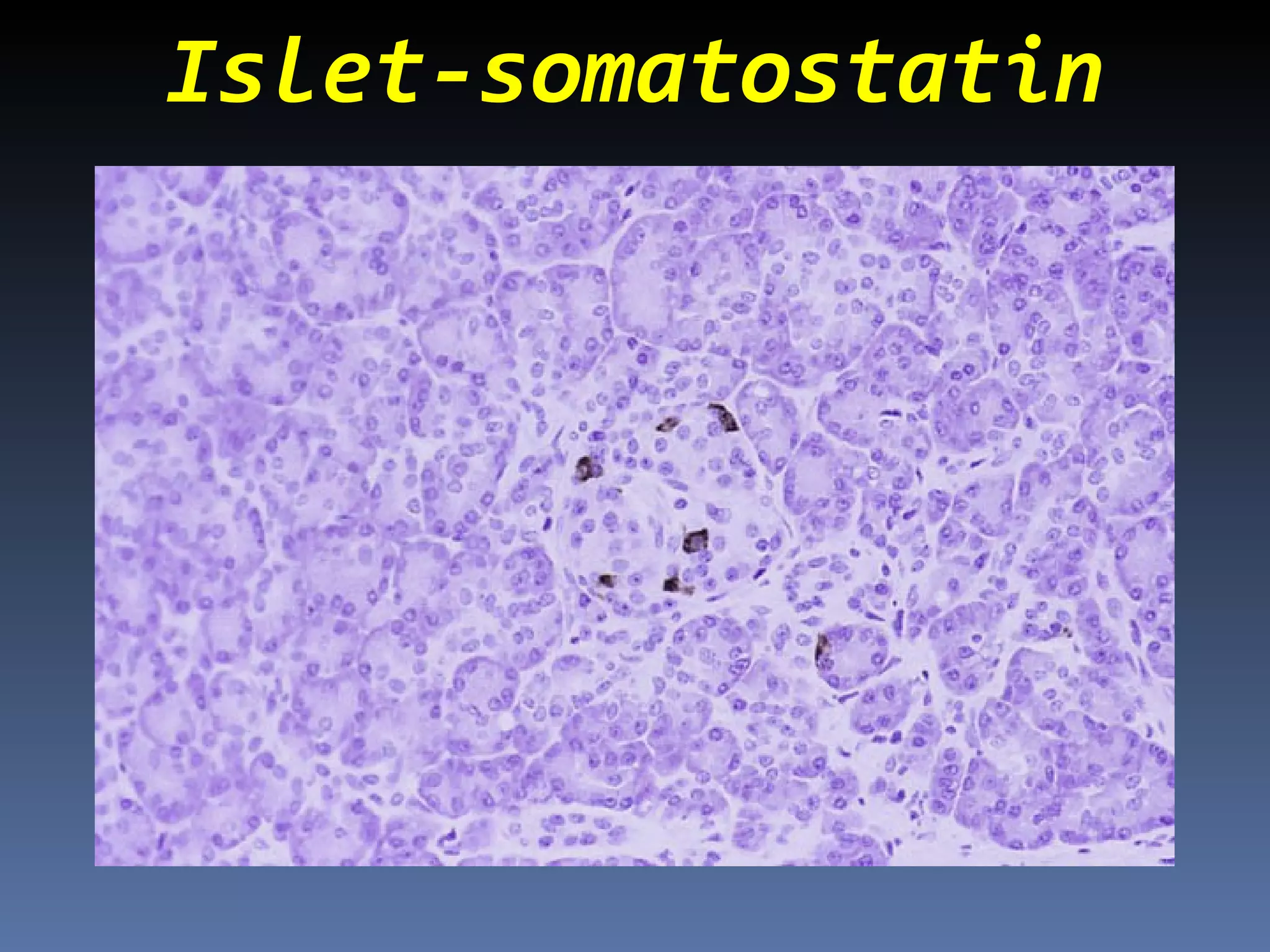 Islet-somatostatin
 