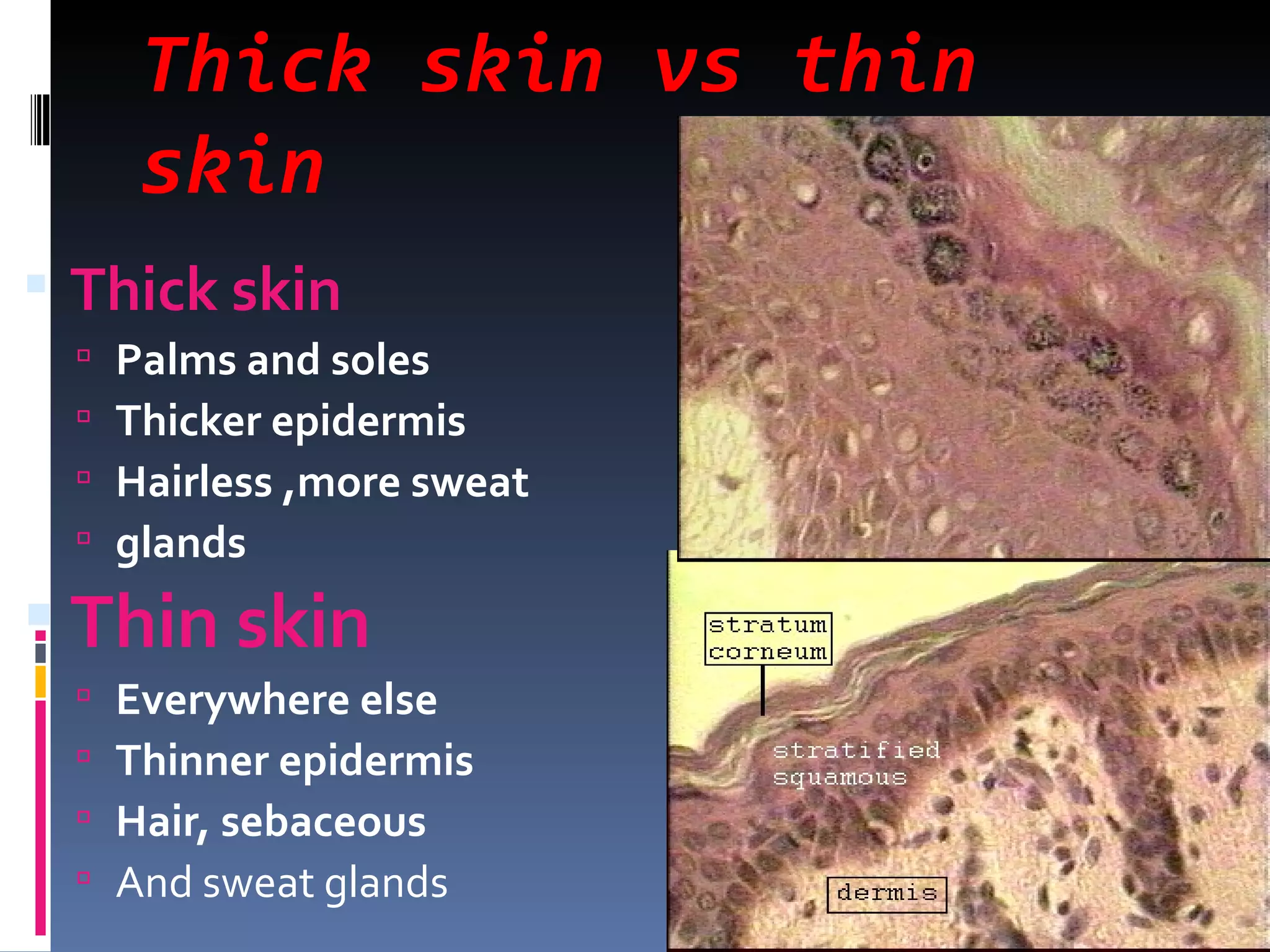 Thick skin vs thin
       skin
 Thick skin
     Palms and soles
     Thicker epidermis
     Hairless ,more sweat
     glands
 Thin skin
     Everywhere else
     Thinner epidermis
     Hair, sebaceous
     And sweat glands
 