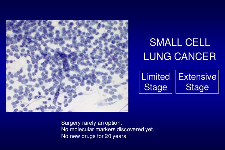 Current Modalities in the Treatment of Lung Cancer