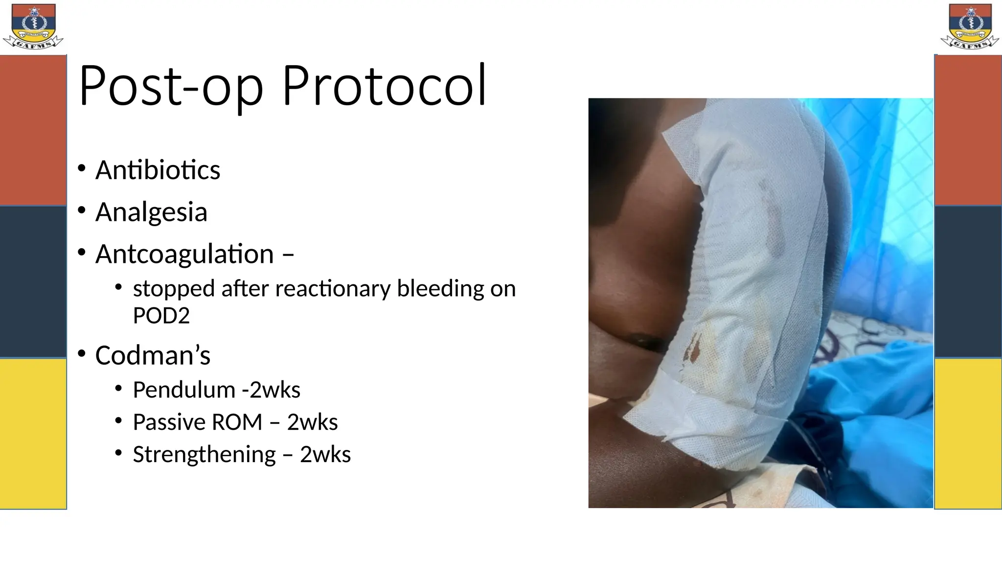 Post-op Protocol
• Antibiotics
• Analgesia
• Antcoagulation –
• stopped after reactionary bleeding on
POD2
• Codman’s
• Pendulum -2wks
• Passive ROM – 2wks
• Strengthening – 2wks
 