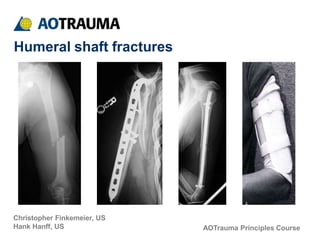 AOTrauma Principles Course
Christopher Finkemeier, US
Hank Hanff, US
Humeral shaft fractures
 