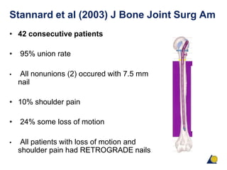 Stannard et al (2003) J Bone Joint Surg Am
• 42 consecutive patients
• 95% union rate
• All nonunions (2) occured with 7.5 mm
nail
• 10% shoulder pain
• 24% some loss of motion
• All patients with loss of motion and
shoulder pain had RETROGRADE nails
 
