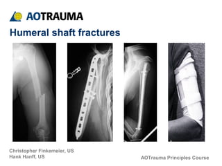 AOTrauma Principles Course
Christopher Finkemeier, US
Hank Hanff, US
Humeral shaft fractures
 