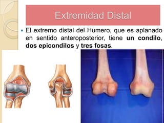 Extremidad Distal


El extremo distal del Humero, que es aplanado
en sentido anteroposterior, tiene un condilo,
dos epicondilos y tres fosas.

 