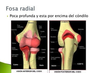  Poca profunda y esta por encima del cóndilo
 