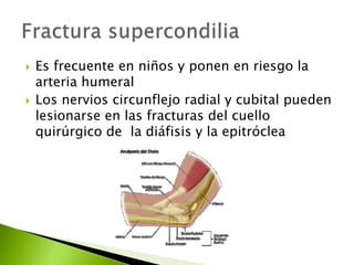  Es frecuente en niños y ponen en riesgo la
arteria humeral
 Los nervios circunflejo radial y cubital pueden
lesionarse en las fracturas del cuello
quirúrgico de la diáfisis y la epitróclea
 