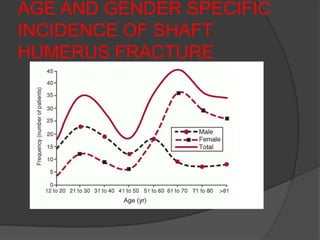 AGE AND GENDER SPECIFIC
INCIDENCE OF SHAFT
HUMERUS FRACTURE
 