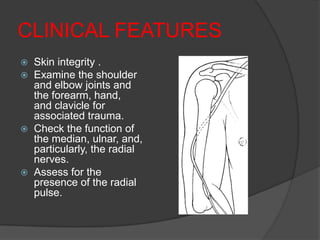 CLINICAL FEATURES
   Skin integrity .
   Examine the shoulder
    and elbow joints and
    the forearm, hand,
    and clavicle for
    associated trauma.
   Check the function of
    the median, ulnar, and,
    particularly, the radial
    nerves.
   Assess for the
    presence of the radial
    pulse.
 