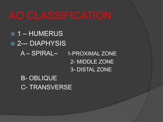 AO CLASSIFICATION
 1 – HUMERUS
 2--- DIAPHYSIS
   A – SPIRAL–   1-PROXIMAL ZONE
                  2- MIDDLE ZONE
                  3- DISTAL ZONE
    B- OBLIQUE
    C- TRANSVERSE
 