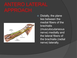 ANTERO LATERAL
APPROACH
             Distally, the plane
              lies between the
              medial fibers of the
              brachialis
              (musculocutaneous
              nerve) medially and
              the lateral fibers of
              the brachialis (radial
              nerve) laterally.
 
