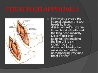 POSTERIOR APPROACH
             Proximally develop the
              interval between the two
              heads by blunt
              dissection, retracting the
              lateral head laterally and
              the long head medially.
              Distally split their
              common tendon along
              the line of the skin
              incision by sharp
              dissection. Identify the
              radial nerve and the
              accompanying profunda
              brachii artery.
 