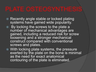 PLATE OSTEOSYNTHESIS
 Recently angle stable or locked plating
  systems have gained wide popularity.
 By locking the screws to the plate a
  number of mechanical advantages are
  gained, including a reduced risk for screw
  loosening and a stronger mechanical
  construct compared with conventional
  screws and plates.
 With locking plate systems, the pressure
  exerted by the plate on the bone is minimal
  as the need for exact anatomical
  contouring of the plate is eliminated.
 