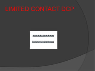 LIMITED CONTACT DCP
 