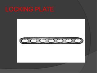 LOCKING PLATE
 