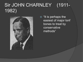 Sir JOHN CHARNLEY         (1911-
1982)
               ―It is perhaps the
                easiest of major lonf
                bones to treat by
                conservative
                methods‖
 