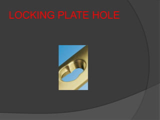 LOCKING PLATE HOLE
 
