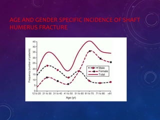 AGE AND GENDER SPECIFIC INCIDENCE OF SHAFT
HUMERUS FRACTURE
 