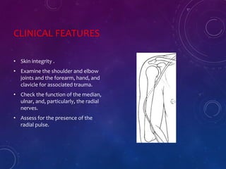 CLINICAL FEATURES
• Skin integrity .
• Examine the shoulder and elbow
joints and the forearm, hand, and
clavicle for associated trauma.
• Check the function of the median,
ulnar, and, particularly, the radial
nerves.
• Assess for the presence of the
radial pulse.
 