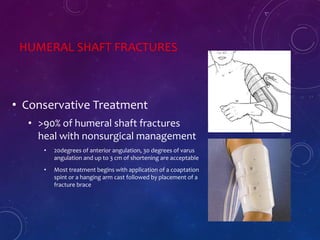 HUMERAL SHAFT FRACTURES
• Conservative Treatment
• >90% of humeral shaft fractures
heal with nonsurgical management
• 20degrees of anterior angulation, 30 degrees of varus
angulation and up to 3 cm of shortening are acceptable
• Most treatment begins with application of a coaptation
spint or a hanging arm cast followed by placement of a
fracture brace
 