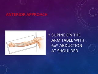 ANTERIOR APPROACH
• SUPINE ON THE
ARM TABLE WITH
600 ABDUCTION
AT SHOULDER
 