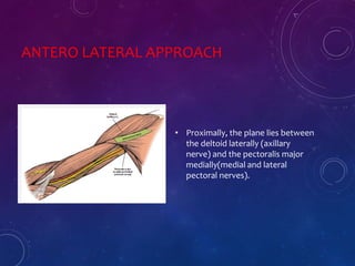 ANTERO LATERAL APPROACH
• Proximally, the plane lies between
the deltoid laterally (axillary
nerve) and the pectoralis major
medially(medial and lateral
pectoral nerves).
 