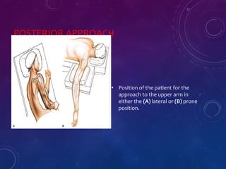 POSTERIOR APPROACH
• Position of the patient for the
approach to the upper arm in
either the (A) lateral or (B) prone
position.
 